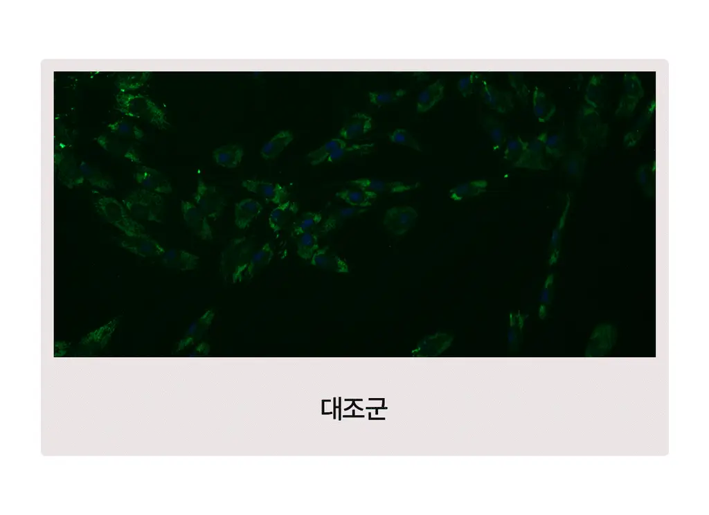 [1+1/유혜주PICK] 바이오던스 포어 퍼펙팅 콜라겐 펩타이드 세럼 30ml 더블 기획 상세페이지 13